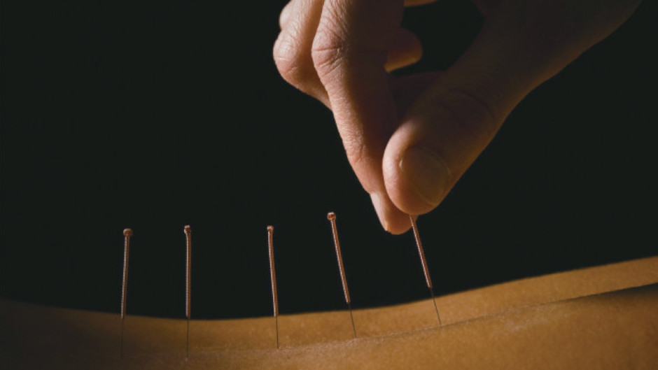 Visit the professionals at Pro Acupuncture Papanui to gain optimal health and wellness, and experience pain relief through ancient Chinese medicine. 