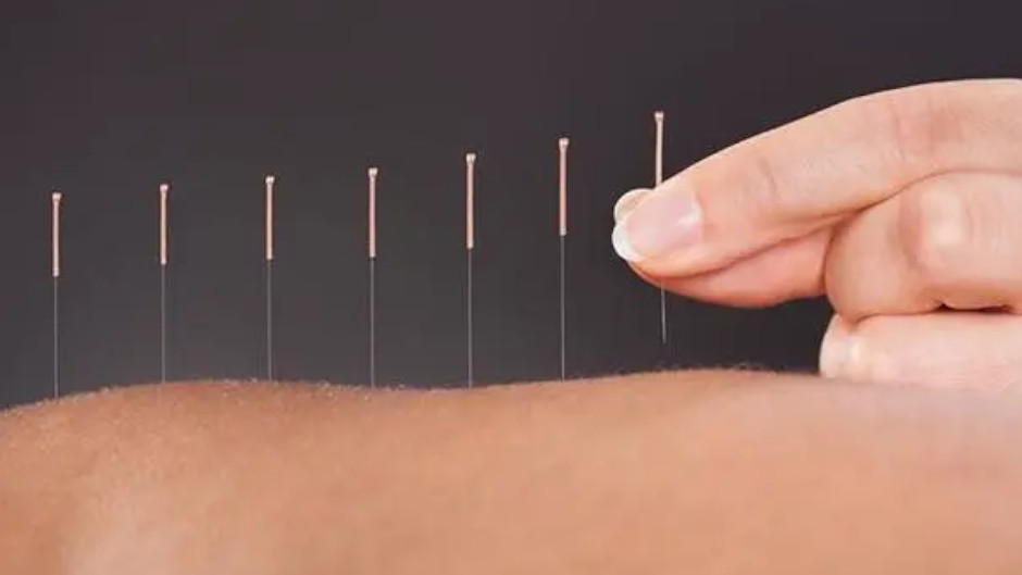 Visit the professionals at Pro Acupuncture Dunedin to gain optimal health and wellness, and experience pain relief through ancient Chinese medicine.